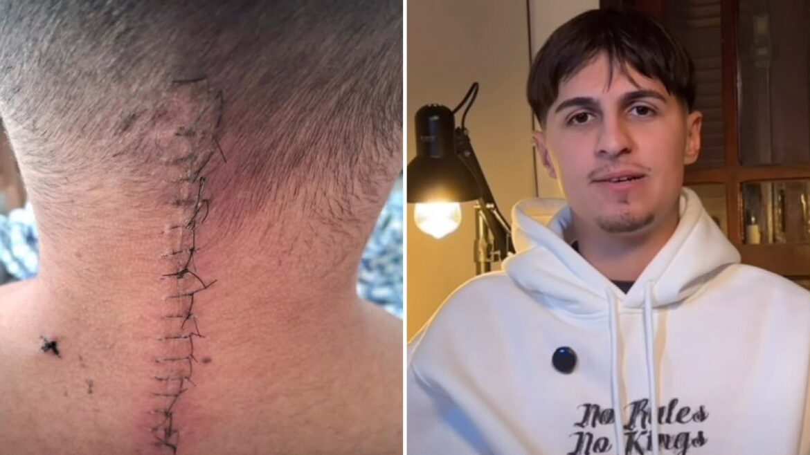 tetraplegico-apos-cirurgia,-jovem-volta-a-andar-e-surpreende-medicos:-‘deus-faz-milagres’